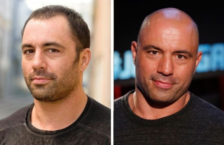 19 Bald Celebrities Before & After Embracing Baldness