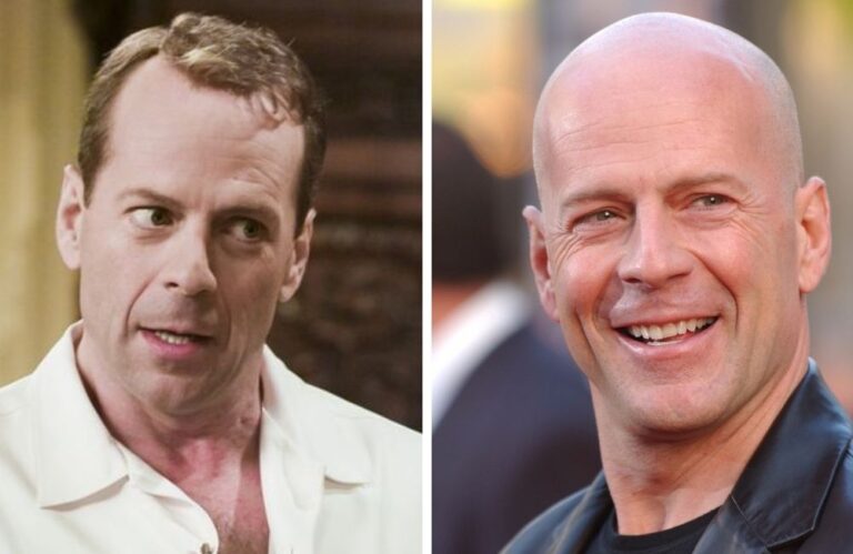 19 Bald Celebrities Before & After Embracing Baldness