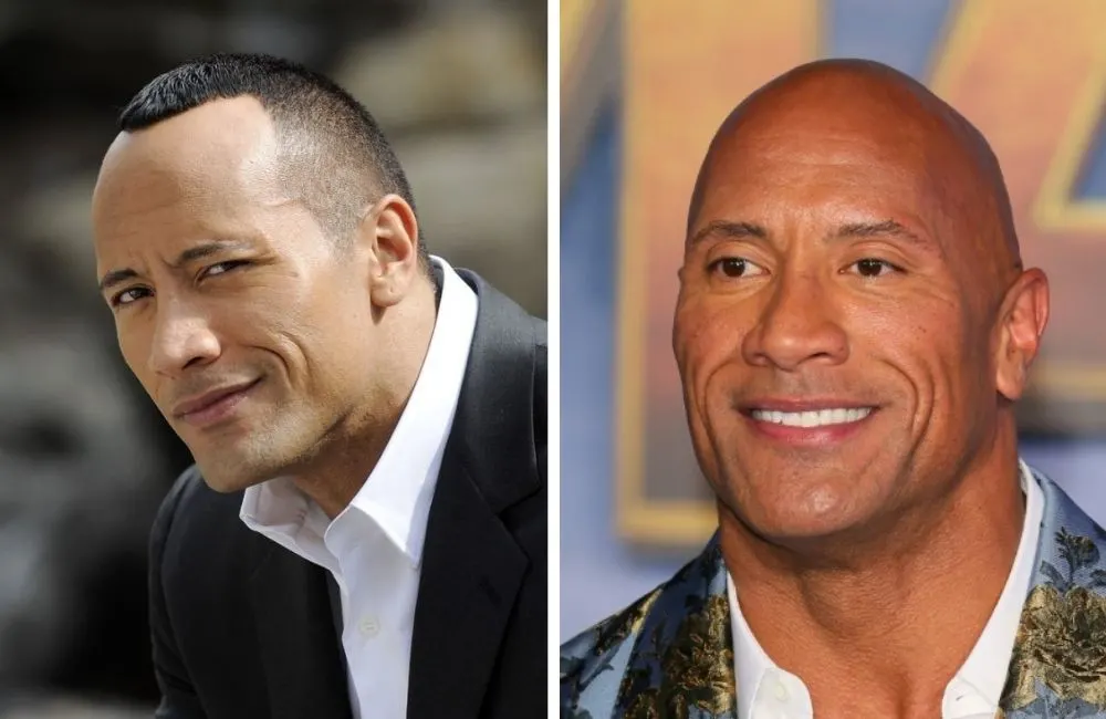 19 Bald Celebrities Before & After Embracing Baldness