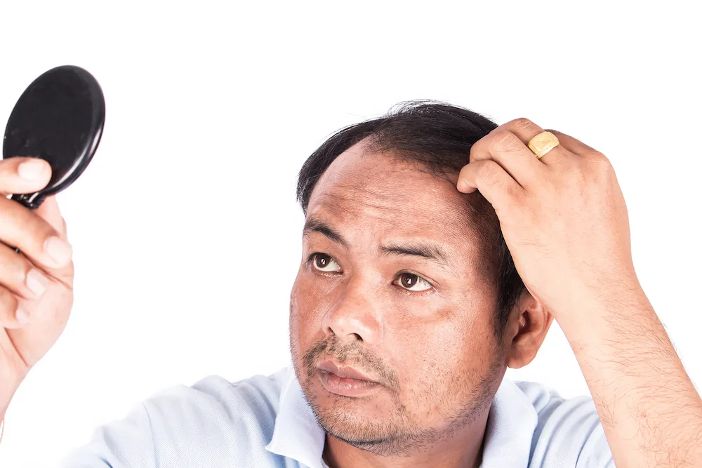 Dealing with hair loss 2