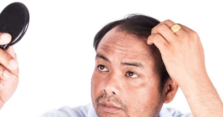 dealing with hair loss
