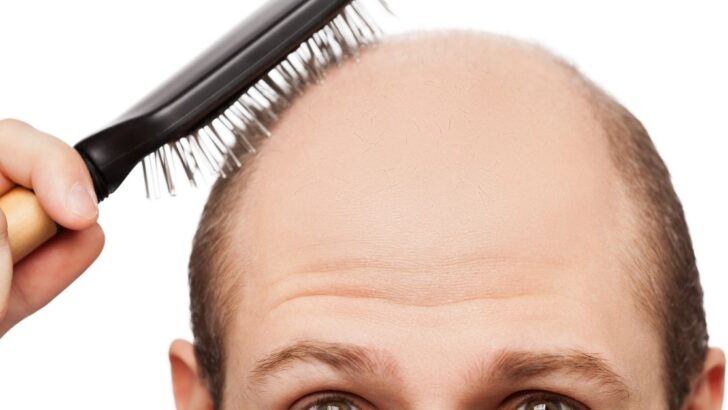 How To Overcome Hair Loss 2