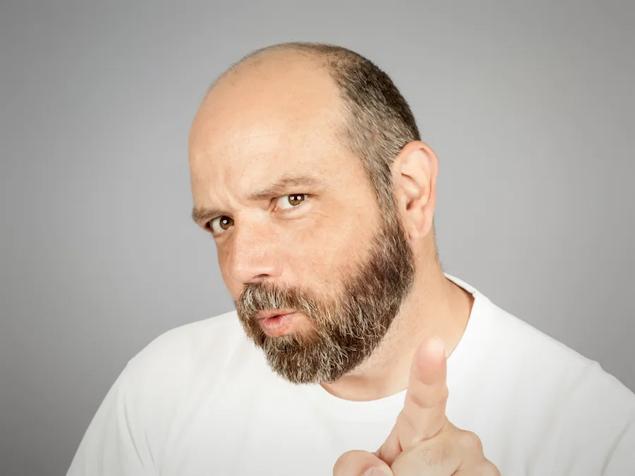 How To Overcome Hair Loss 2