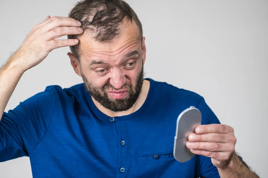 Balding how to handle it