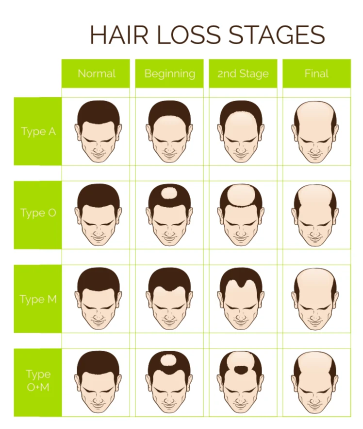 What Causes Hair Loss