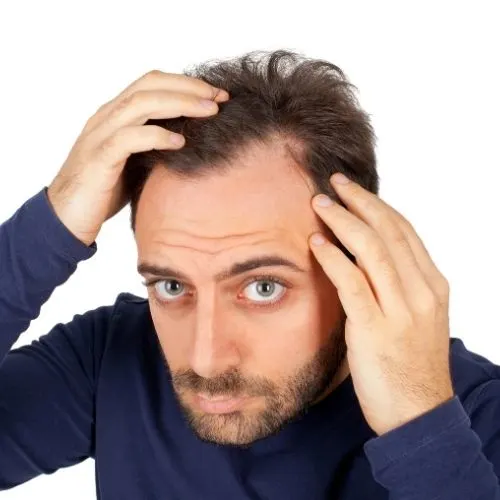 How To Stop Hair Loss In Men