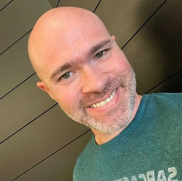overcome balding