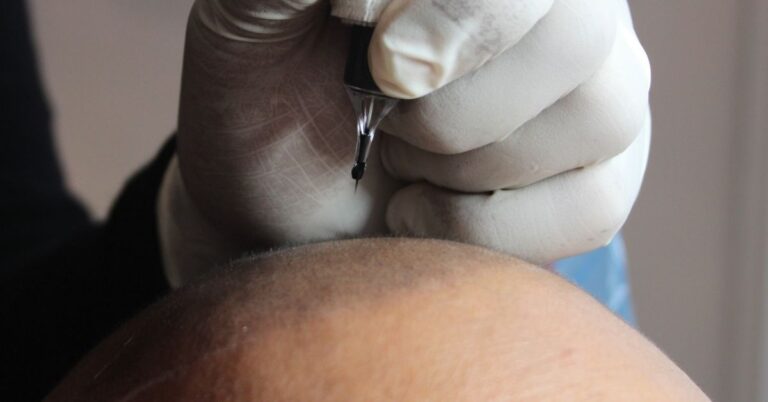 Scalp Micropigmentation interview EVe