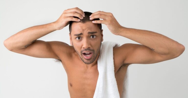 going completely bald
