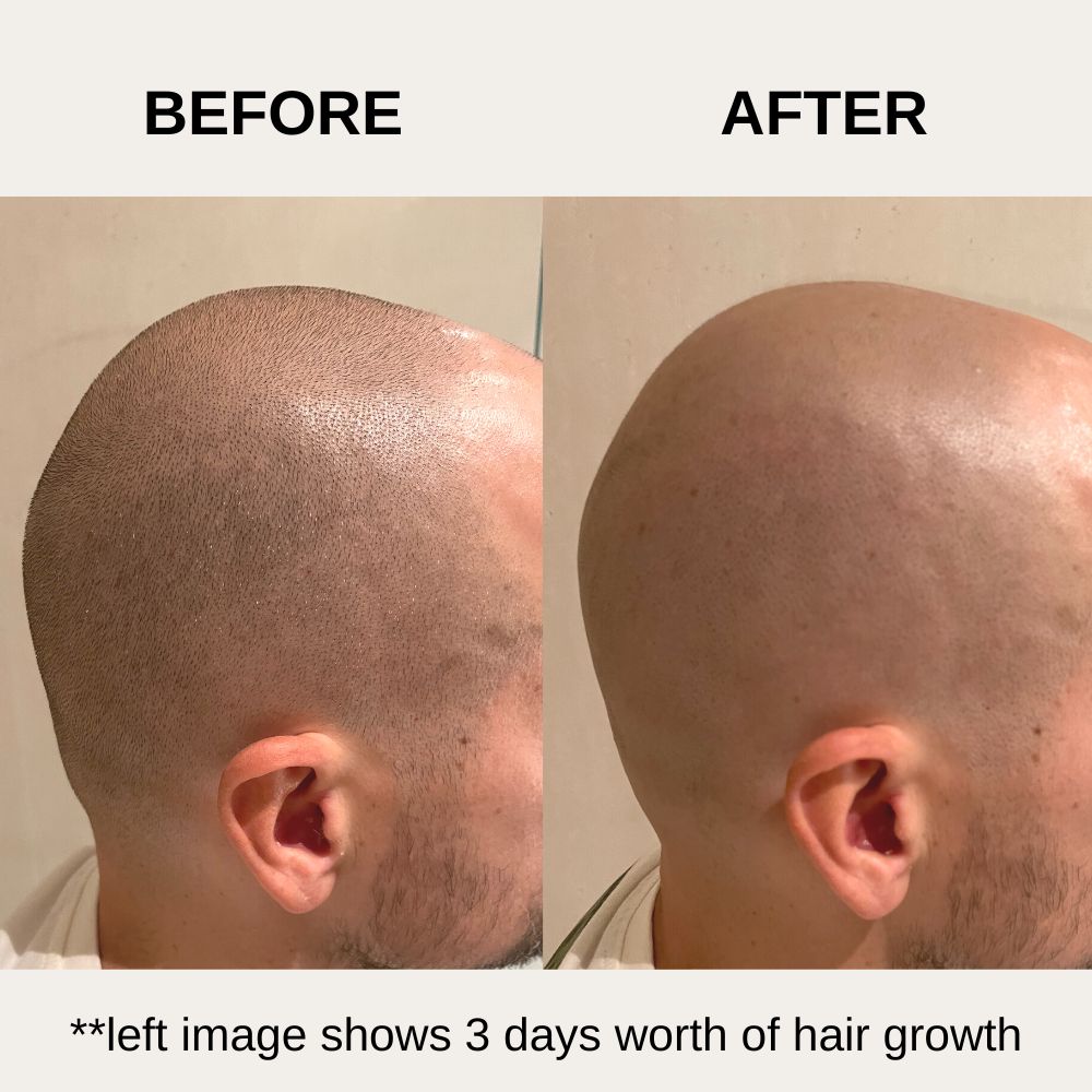 Head shaver electric Before & After